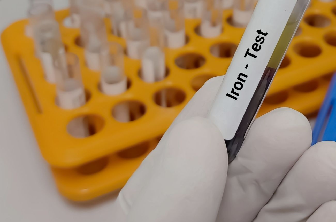 Online Iron Screening Pack by blog.cult.fit